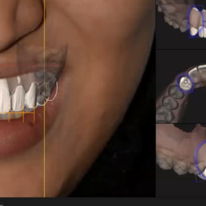 DSD in digital dentistry