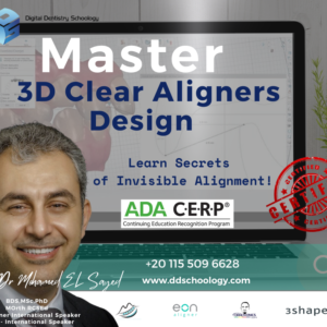 clear aligner