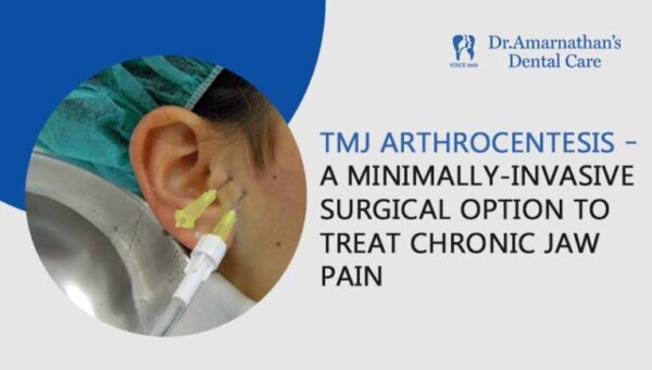 TMJ Disc Displacement with and without Reduction: Diagnosis, Treatment ...