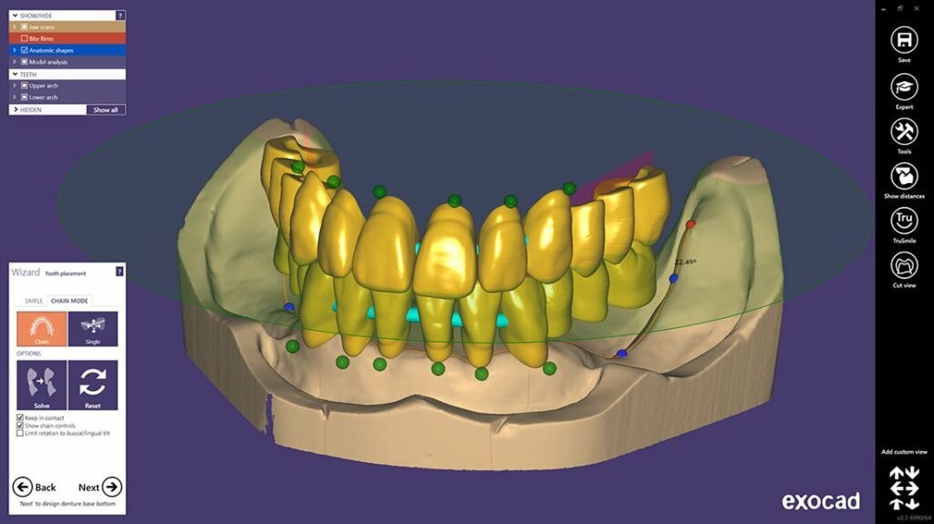 exocad_DentalCAD_Full-Denture-Module_Tooth-setup-1