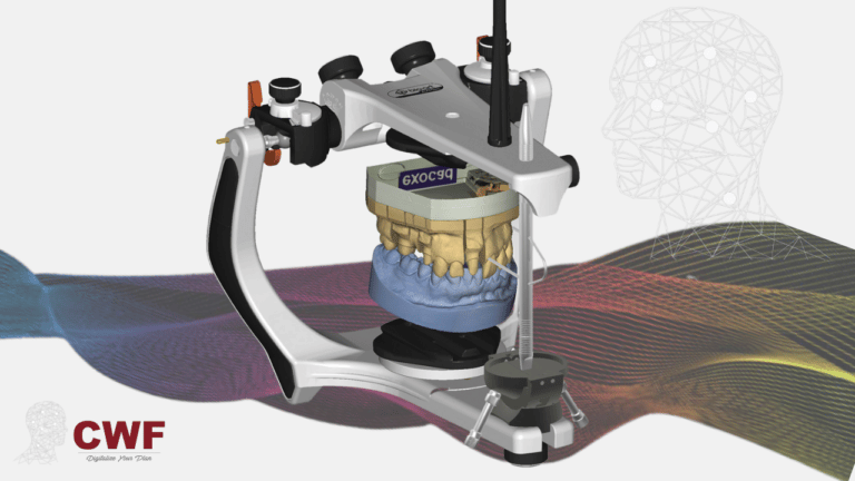 exocad virtual articulator