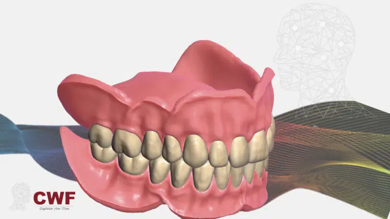 Home 21 Digital Complete Denture Design with Exocad — Full Masterclass
