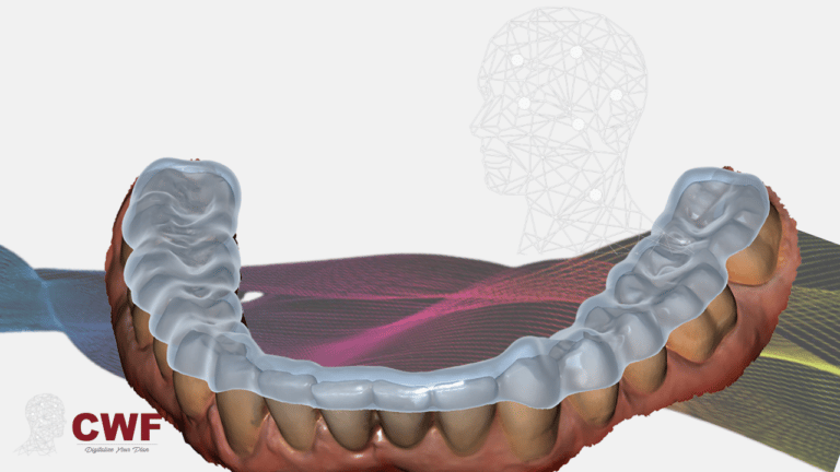 Master exocad Bite Splint module