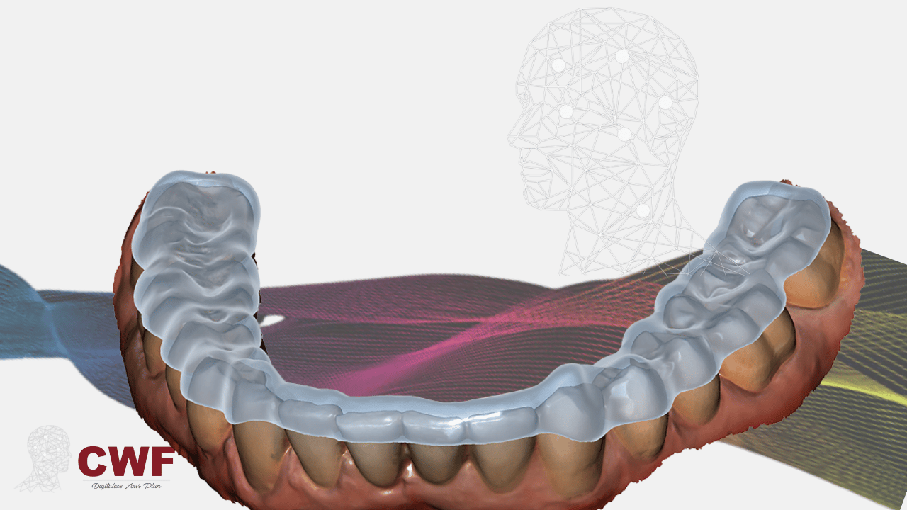 Master exocad Bite Splint module