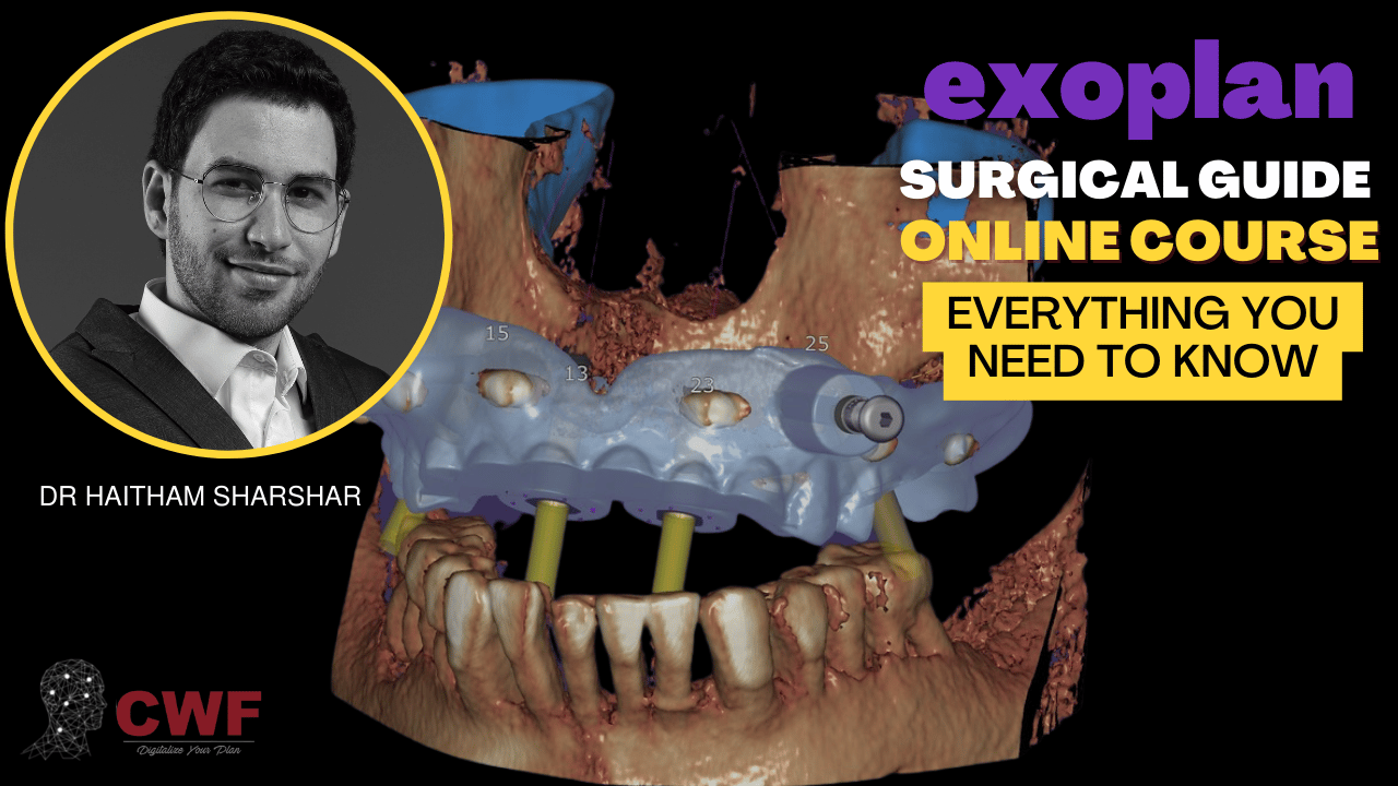 exoplan surgical guide Course