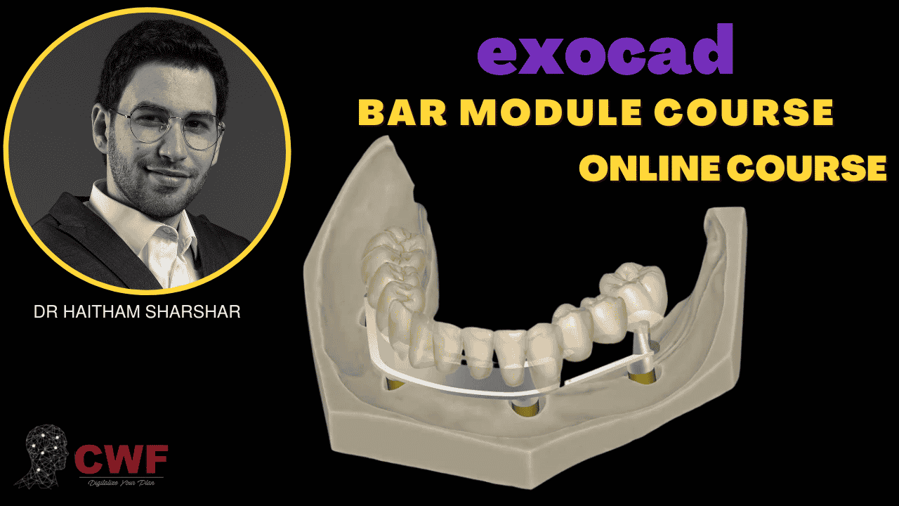 exocad Bar Module