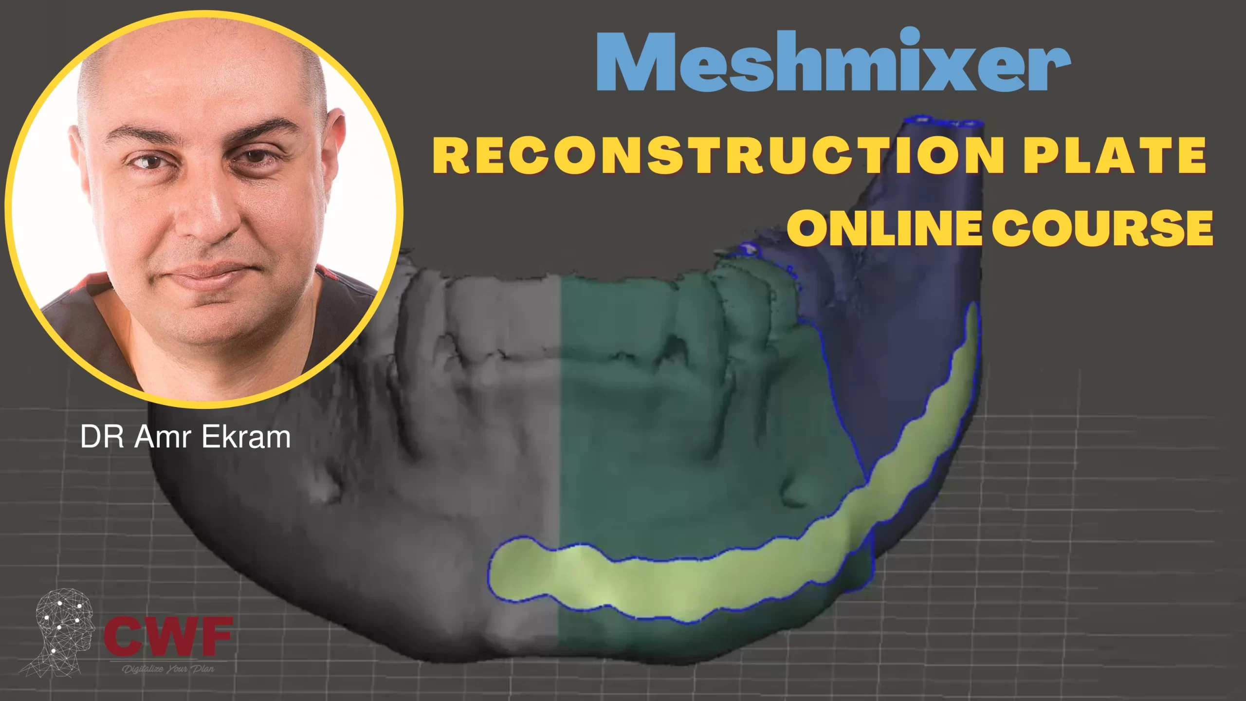 Digital Design of Maxillofacial Plate