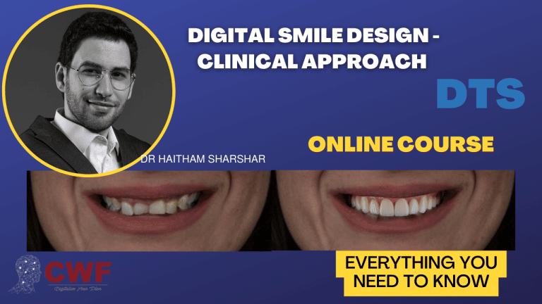 Digital Smile Design – Clinical Approach