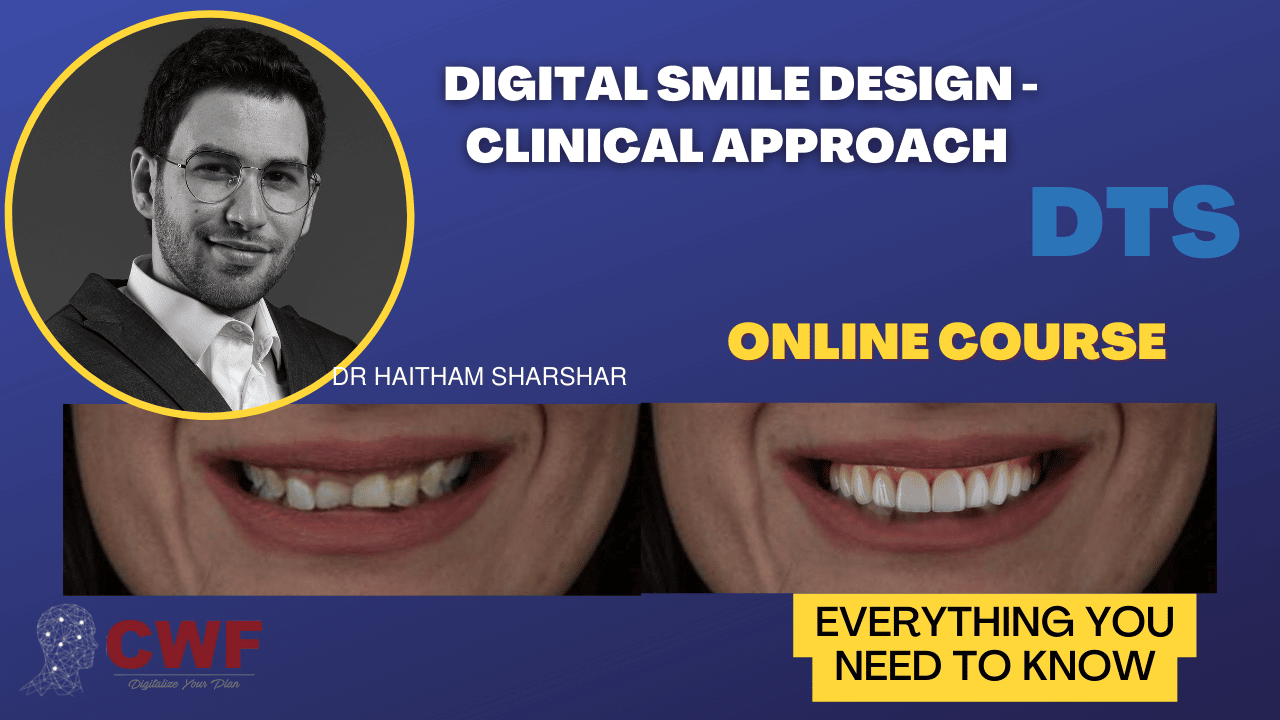 Digital Smile Design – Clinical Approach