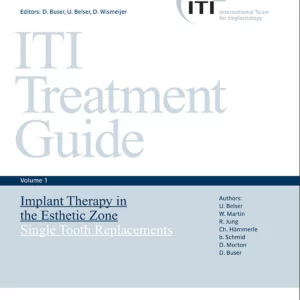 dental implant planning