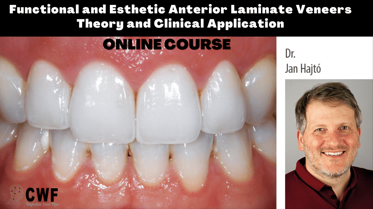 Master Functional and Esthetic Anterior Laminate Veneers -Theory and Clinical Application