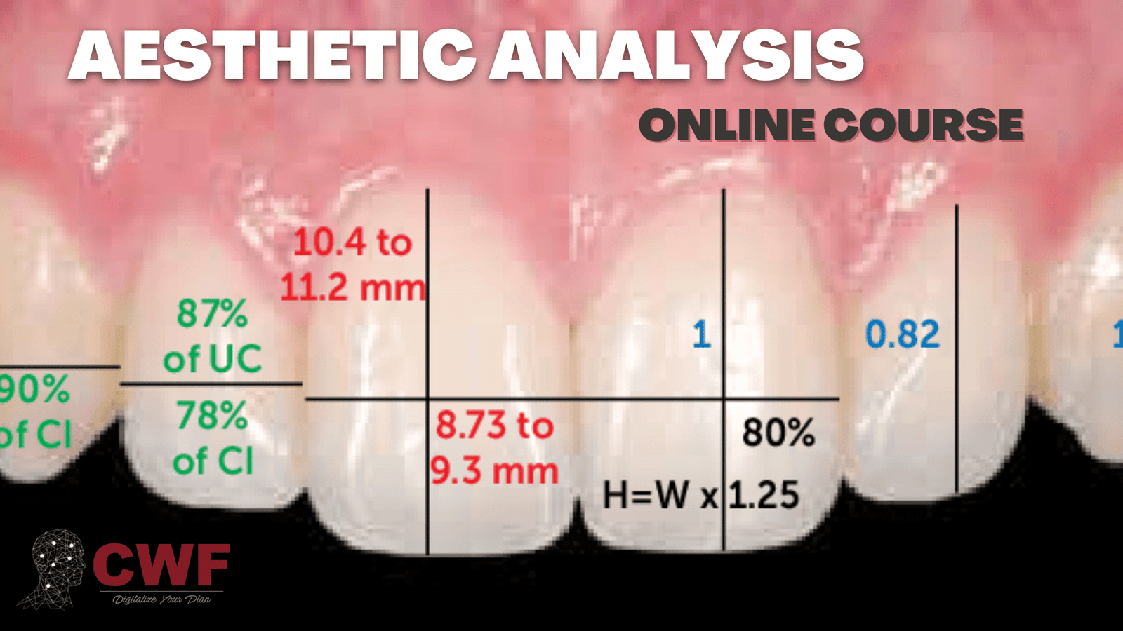 Esthetic Analysis