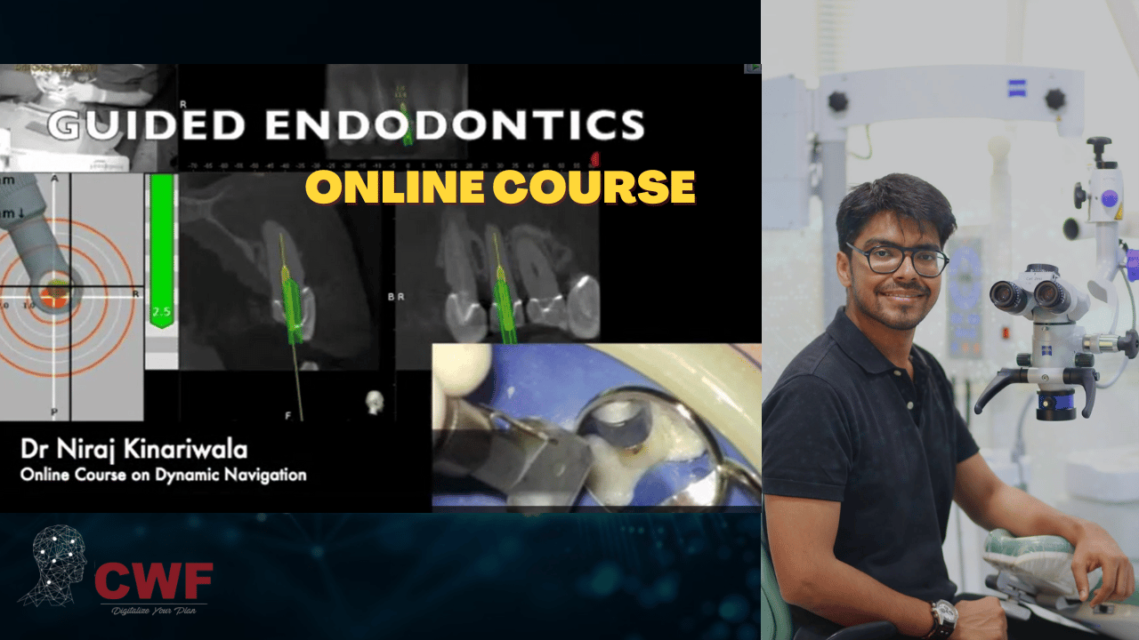 Digital endodontics & Dynamic Navigation