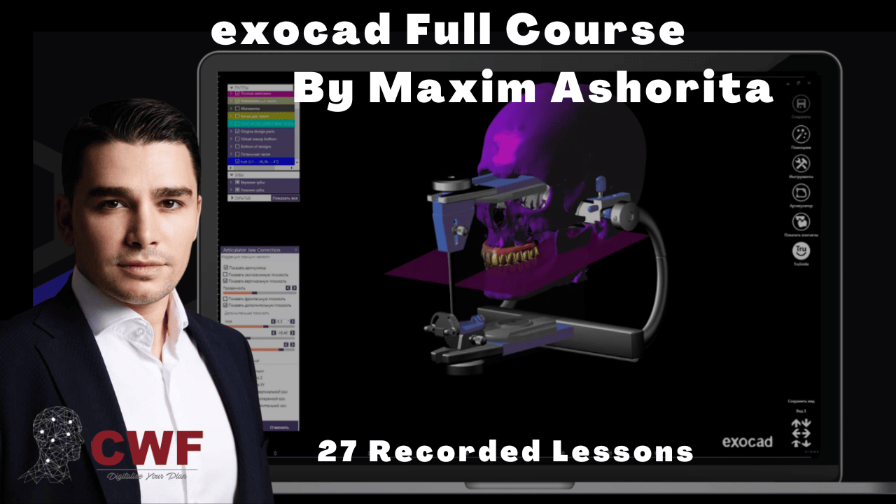Master exocad Full Course-Max Ashorita