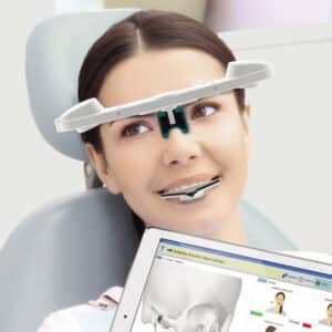 JMA Optic_Digitaldentistry_Jaw motion