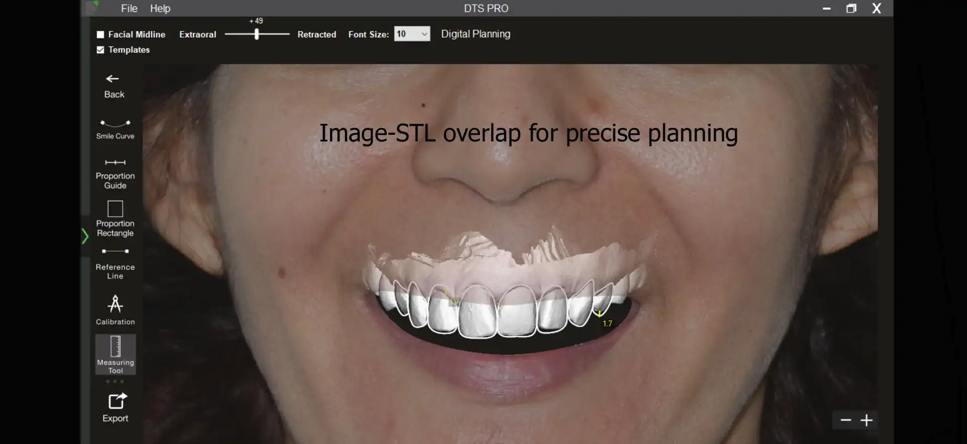 Dental treatment simulation 3d (DTS)