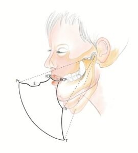 occlusion - envelope of motion