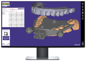 jaw motion_exocad_jma optic_dr haitham sharshar_digitaldentistryschoology