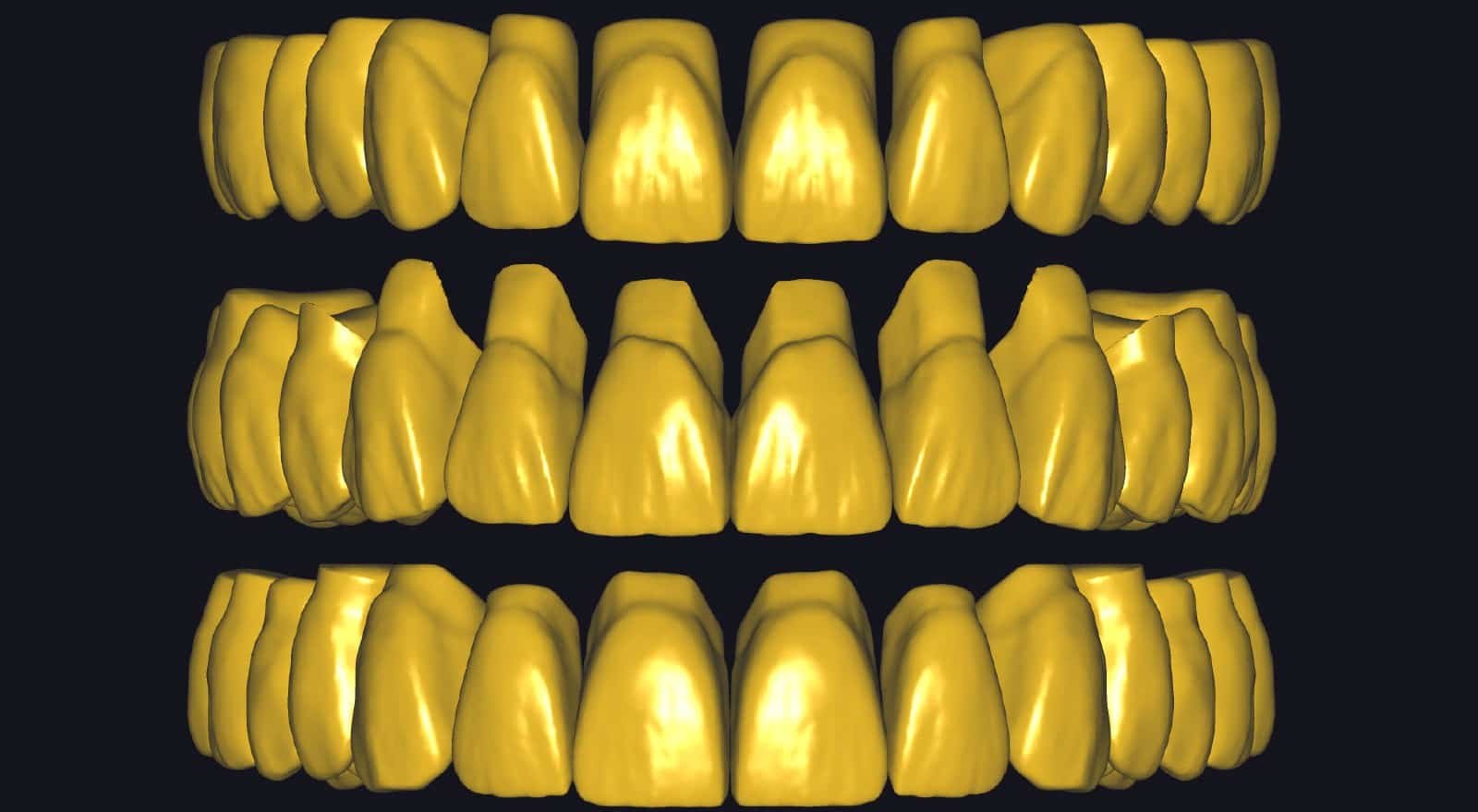 Premium Exocad Library for Digital Dentistry - Elevate Your Dental Practice 1 exocad library