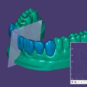 3D Mock up exocad design lesson