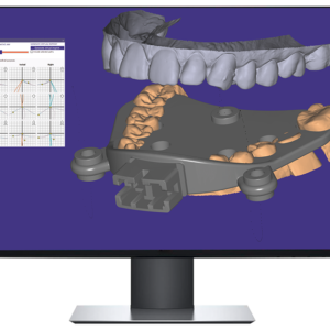 digital jaw tracking integration between zebris -exocad