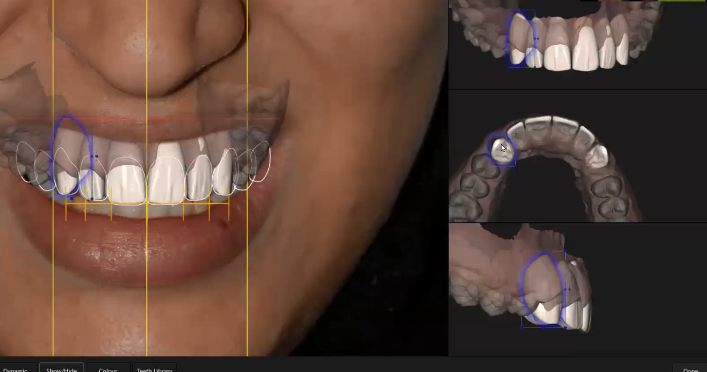 DTS 3D- SMILEDESIGN Record