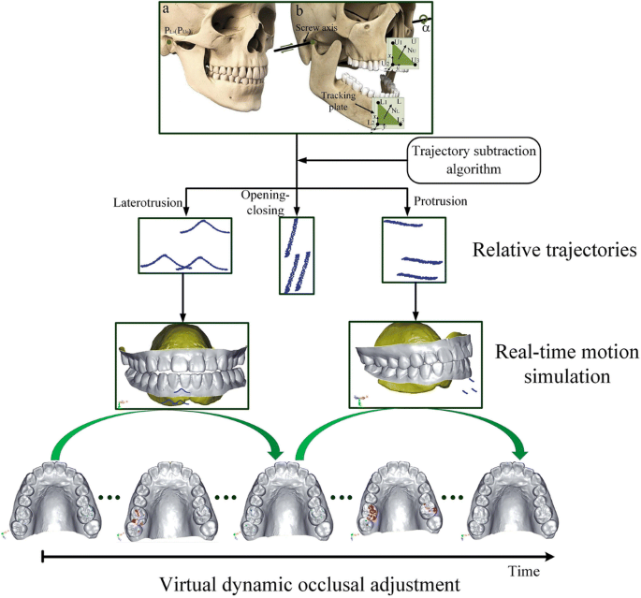 Dynamic Occlusal Adjustments in Prosthodontics 1 1 1