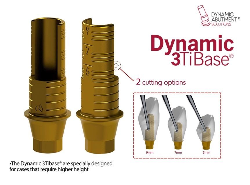 Dynamic Abutments & AI in Implantology 1 1