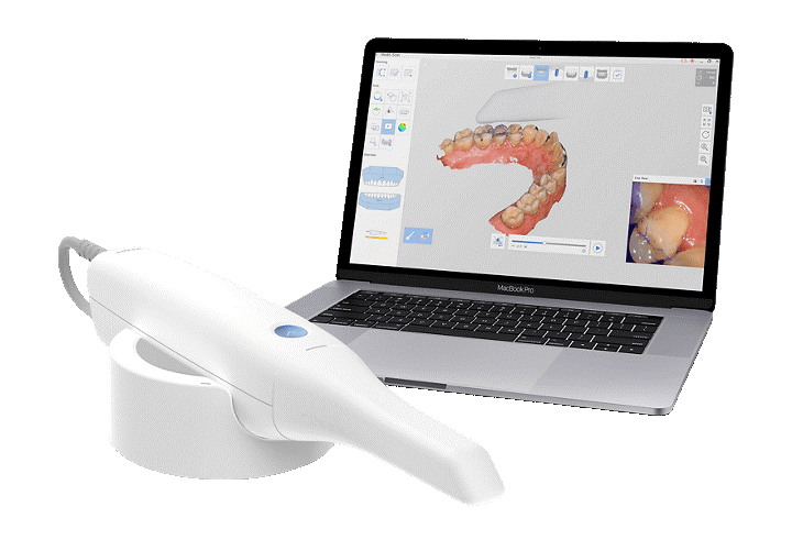 Dynamic Occlusal Adjustments in Prosthodontics 4 4 1