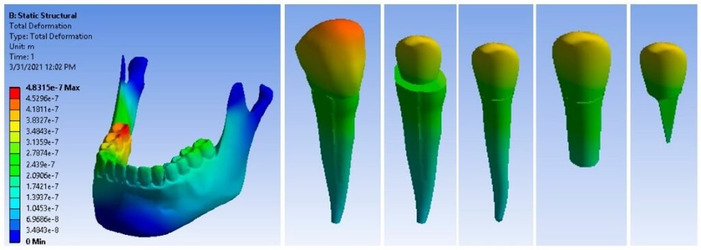 Dynamic Abutments & AI in Implantology 6 6