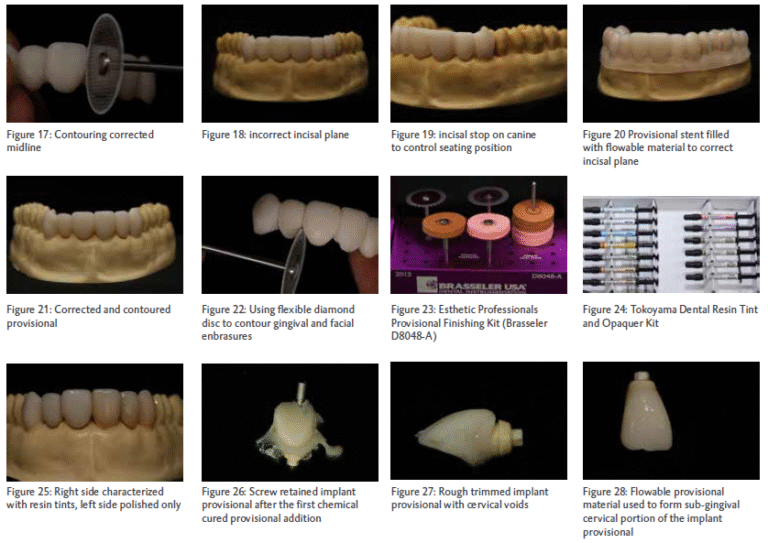 The Role of Provisional Restorations in Aesthetic Outcomes: A Comprehensive Guide to Aesthetic and Cosmetic Prosthodontics
