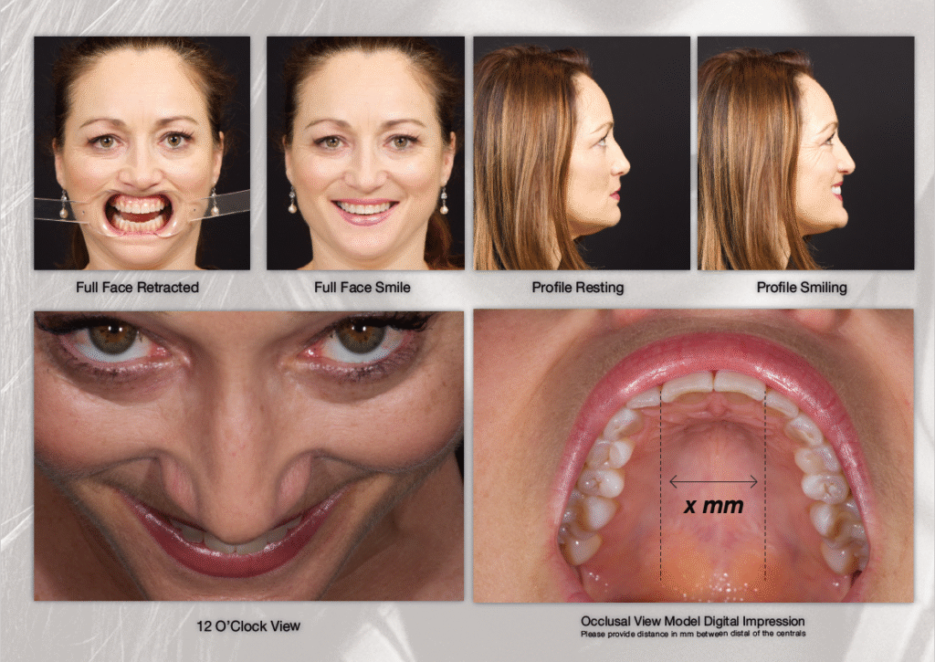 Digital Photography in Aesthetic Evaluation: A Game-Changer for Aesthetic and Cosmetic Prosthodontics 1 1 3