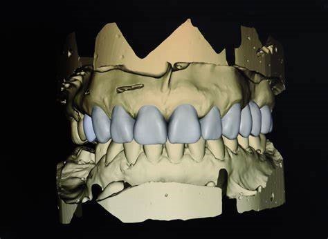 Patient-Centered Aesthetic Treatment Planning in Cosmetic Prosthodontics: A Comprehensive Approach 10 10 4