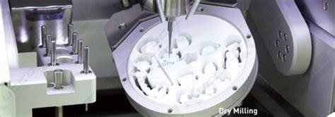 Managing Midline Diastemas with Aesthetic Restorations: Contemporary Approaches in Cosmetic Prosthodontics 11 11 3