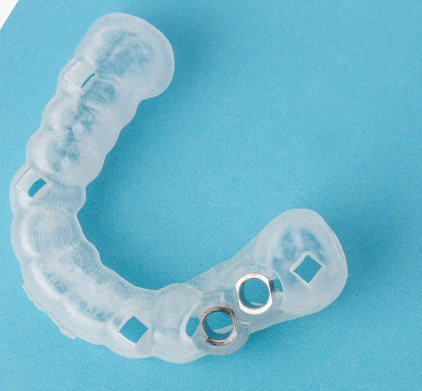 Digital Implant Planning with Surgical Guides: A Comprehensive Guide for Modern Dentistry 11 11 3