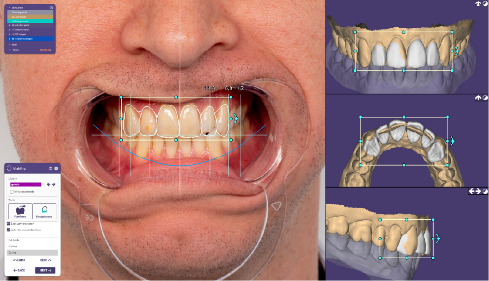 Managing Midline Diastemas with Aesthetic Restorations: Contemporary Approaches in Cosmetic Prosthodontics 33 12 1