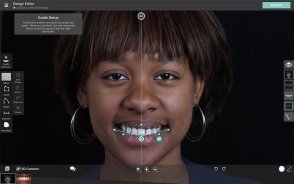 Digital Photography in Aesthetic Evaluation: A Game-Changer for Aesthetic and Cosmetic Prosthodontics 16 12