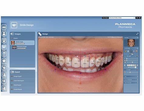 Digital Photography in Aesthetic Evaluation: A Game-Changer for Aesthetic and Cosmetic Prosthodontics 17 13