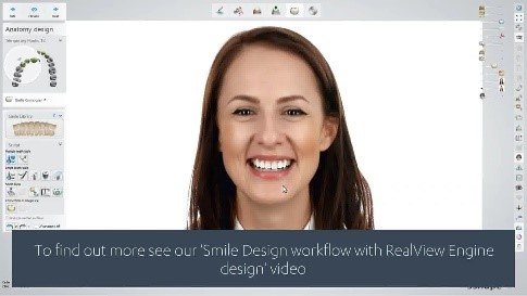 Managing Midline Diastemas with Aesthetic Restorations: Contemporary Approaches in Cosmetic Prosthodontics 37 14 3