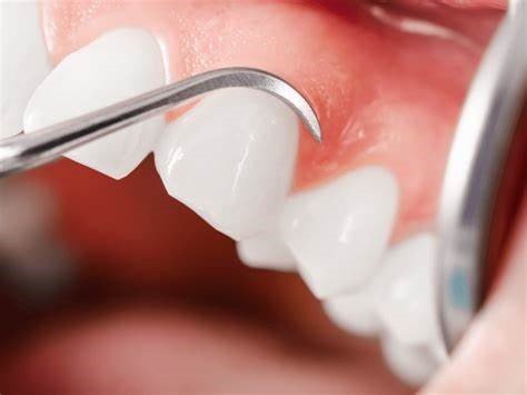 Patient-Centered Aesthetic Treatment Planning in Cosmetic Prosthodontics: A Comprehensive Approach 1 2 11