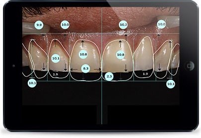 Patient-Centered Aesthetic Treatment Planning in Cosmetic Prosthodontics: A Comprehensive Approach 13 2 19