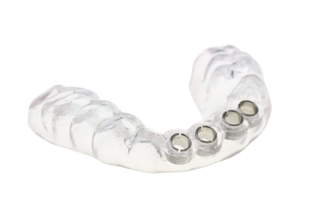 Digital Implant Planning with Surgical Guides: A Comprehensive Guide for Modern Dentistry 2 2 37