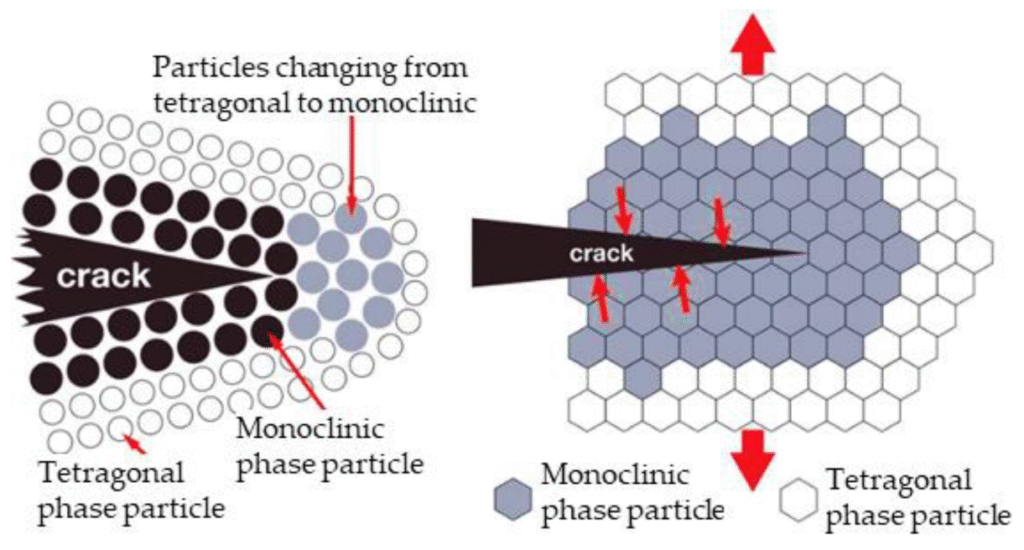 Zirconia vs Ceramics in Modern Dentistry: A Comprehensive Comparison 2 3 21