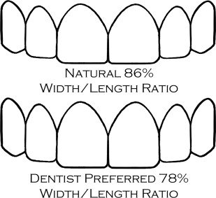 Managing Tooth Proportions for Harmonious Smiles: A Comprehensive Guide to Aesthetic and Cosmetic Prosthodontics 3 3 23