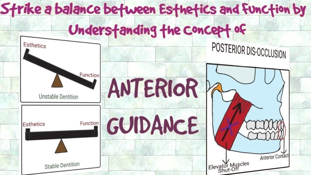Managing Midline Diastemas with Aesthetic Restorations: Contemporary Approaches in Cosmetic Prosthodontics 2 3 8