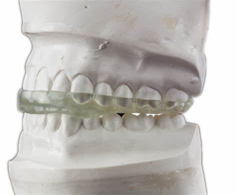 Orofacial Pain and Muscle Spasm: A Comprehensive Guide for Dental Practitioners 3 4 22