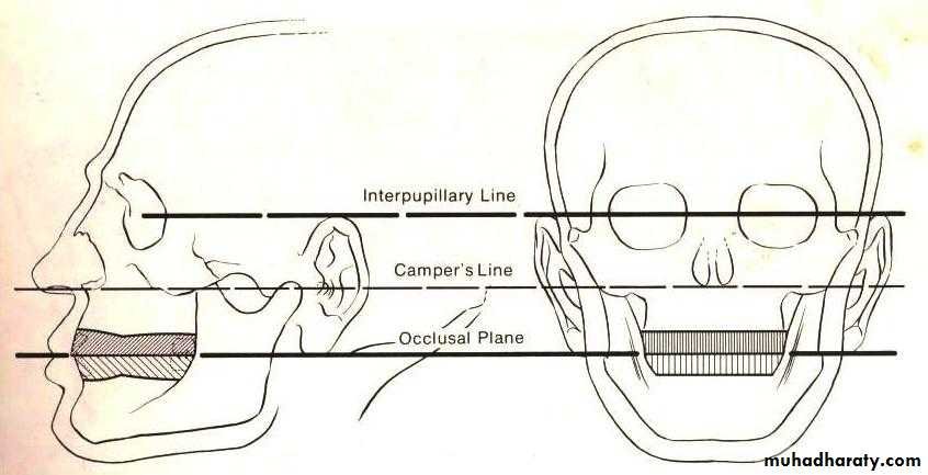 Smile Design Principles in Full Mouth Rehabilitation: Aesthetic and Cosmetic Prosthodontics 4 4 27