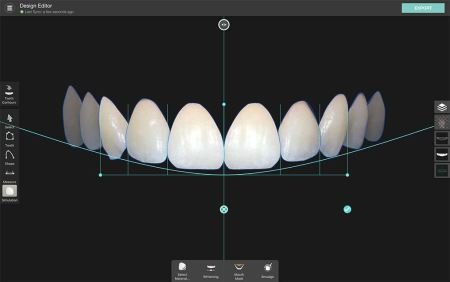 Managing Tooth Proportions for Harmonious Smiles: A Comprehensive Guide to Aesthetic and Cosmetic Prosthodontics 4 4 28