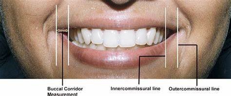 Patient-Centered Aesthetic Treatment Planning in Cosmetic Prosthodontics: A Comprehensive Approach 4 5 10