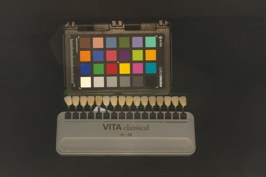 Digital Photography in Aesthetic Evaluation: A Game-Changer for Aesthetic and Cosmetic Prosthodontics 5 5 4